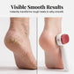 🎁Last Day Promotion 49% OFF🔥Double-Sided Foot Scraper for Callus Removal